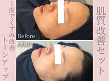 ネオファースト(NeoFirst)/くすみも飛んでトーンアップ♪