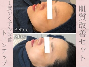 ネオファースト(NeoFirst)/くすみも飛んでトーンアップ♪