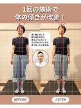 スペックフィジカルコンディショニング(SPECフィジカルコンディショニング)/50代女性/姿勢ビフォーアフター