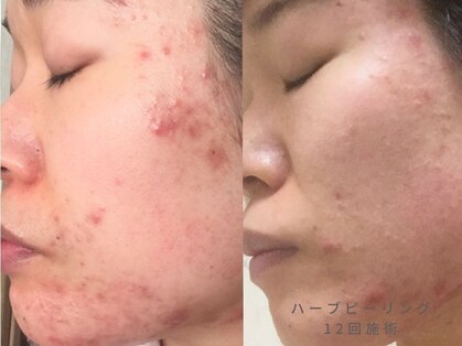 カラーデザインサロン(COLOR DESIGN SALON)の写真