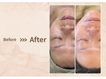 プラム(plum)/セルマン