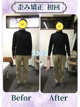 アミーゴ整体院/ビフォーアフター