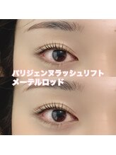 レディエント(Radiant)/パリジェンヌ/メーテルロッド