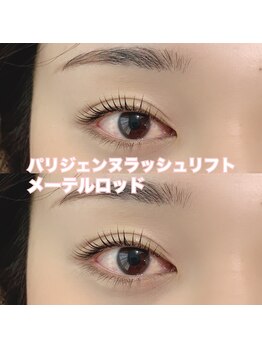 レディエント(Radiant)/パリジェンヌ/メーテルロッド