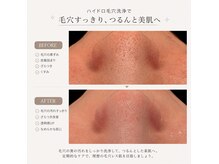 クラルテアンドコー(Salon Clarte&Co.)の雰囲気(あら不思議★2種類の美容液で詰まりが浮き出ししっかり引き締め)