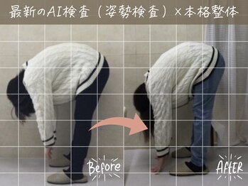 ナオル整体 荻窪院(NAORU整体)/before/after【6】荻窪/整体