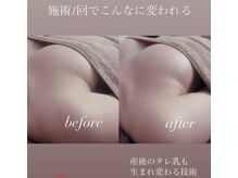 クリソレース(Chrysolace)の雰囲気（バザルトバストコース。全身のスタイルアップにふわふわバストへ）