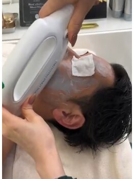 エルサ(Elsa)/プラズマ光ピーリング脱毛