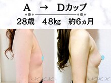 メディカルサロン エム エム エム 心斎橋本店(M.M.M)の雰囲気(発育阻害因子を徹底改善!だから痩せ型さんでもバストアップ可能)