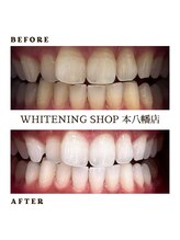 ホワイトニングショップ 本八幡店/短期間で最大限に白く☆