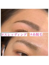 ジェルメ(Germer)/眉糸脱毛