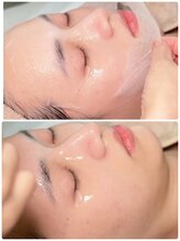 ユーキャン(You Can)/小顔(フェイシャル)