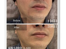 アールベルサロン(R bel salon)