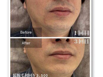 アールベルサロン(R bel salon)