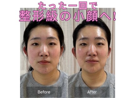 アネラ 南森町(ANERA)の写真