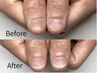【メンズ深爪】120分で清潔な指先へ!噛み癖・深爪を自爪風に即改善¥31900→