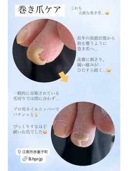 トラブルネイル