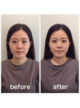 美容整体プラスフィール 恵比寿本店/小顔・口角の高さ