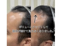 ルチル(Rutile)/頭皮プロセルセラピーズ