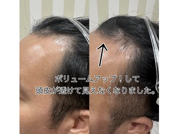 ルチル(Rutile)/頭皮プロセルセラピーズ