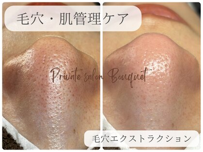 ブーケ(Bouquet)の写真