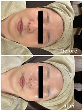 ジャスミン(Jasmin)/ホワイトニングフェイシャル