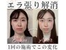 人気No.3【エラ張り瞬間解消】憧れのV字ライン形成★本格小顔矯正30分￥4900