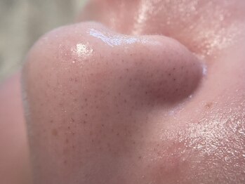 リセットプラス(Reset+)/お鼻の産毛目立っていませんか？