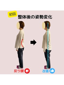 ベルス(BELTH)/姿勢変化－産後の反り腰－