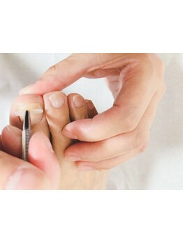 爪の悩みを解消できる（ケア含む）