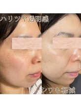 キレイノココロミ(きれいのCoCoRomi)/