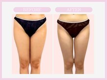 スリムライン 秋田店(The Slim Line)/before→after