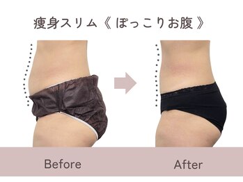 ティファニー/痩身スリム