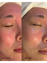 ダイダイ(daidai)/before→after　3回目