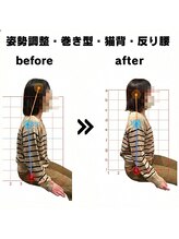 ただのばんそう整体院 吉祥寺/姿勢改善例