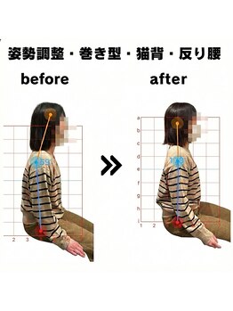 ただのばんそう整体院 吉祥寺/姿勢改善例