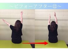 ケアるら整骨院 富里院/ビフォーアフター