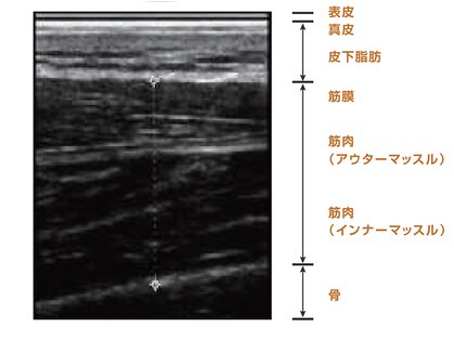 クルスカリダクションの写真