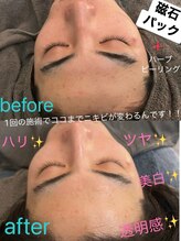 サリエ(S'allier)/毛穴ケア、肌質改善