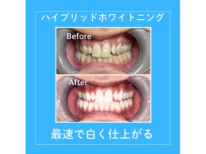 シャイニング 岩出店(SHINING)の写真