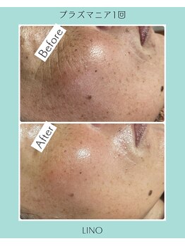 リノ(Lino)/大人気メニュー♪