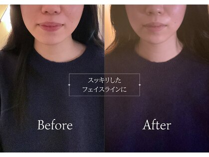 リンドウ 赤坂店(RINDO)の写真