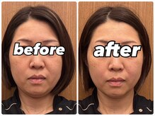 王子溝田橋整骨院 整体院の雰囲気（《美容鍼》法令線やたるみケア！毛穴なしのトーンアップ美肌へ！）