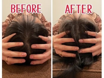 ジェイペック鍼灸整骨院/頭痛ケア(小顔ヘッドマッサージ)