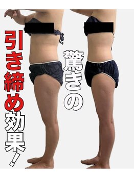 パームボーテ(Palm Beaute)/一石二鳥！お顔もスッキリ！