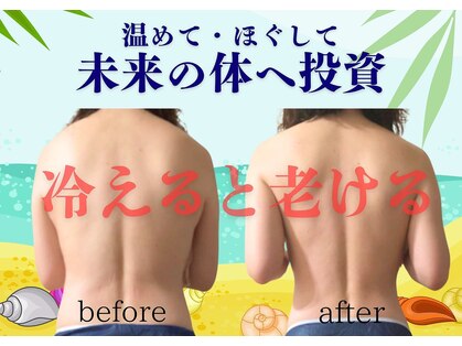アーブル(arbre)の写真