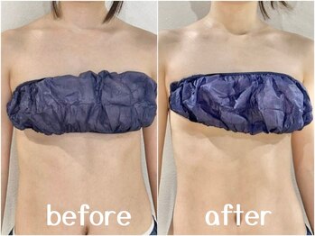 サロン ド ブラン アオヤマ(Salon de BLANC AOYAMA)/大人の徹底痩身100分