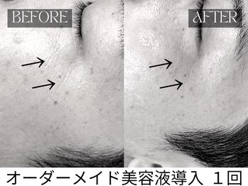 スキンジム(SKIN GYM)/小皺改善で第一印象を底上げ◎