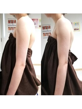 RiとBiのたまご/(ブライダル)引き締め