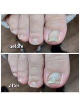 爪切り屋 足楽/強い巻きには